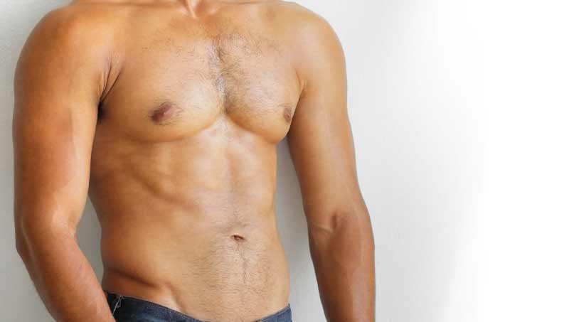  qué es la gynecomastia