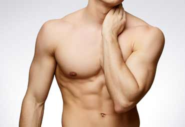 gynecomastia